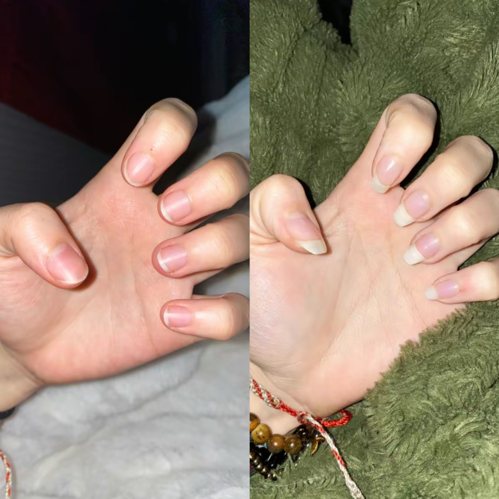 Magic Nail Growth Elixir