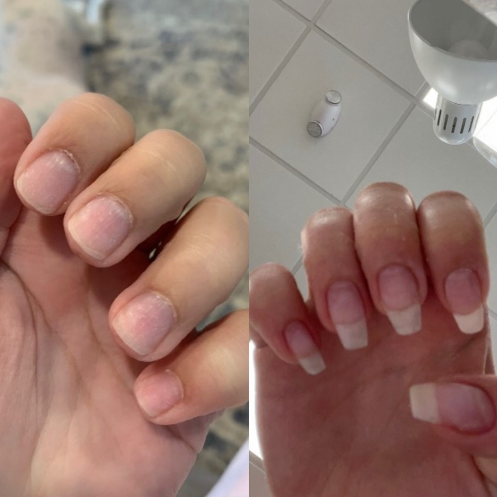 Magic Nail Growth Elixir