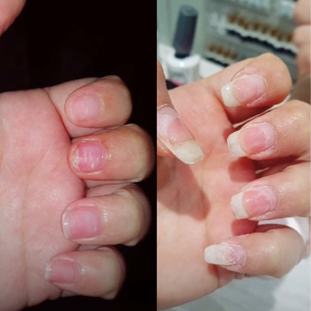 Magic Nail Growth Elixir