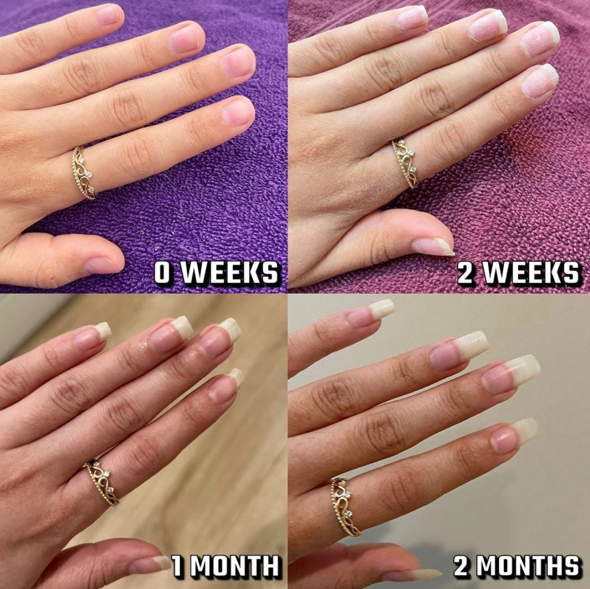 Magic Nail Growth Elixir