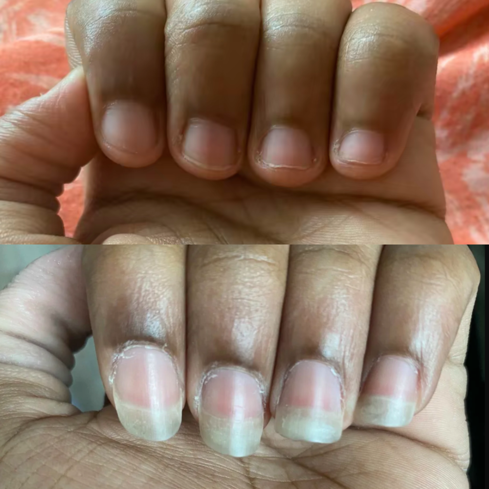Magic Nail Growth Elixir